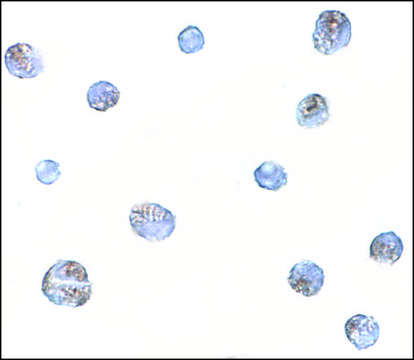 Anti-NORRIN antibody produced in rabbit