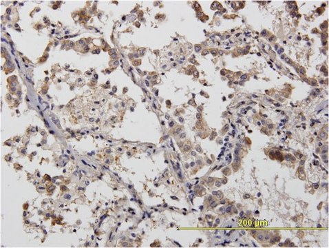 Monoclonal Anti-ACTN4 antibody produced in