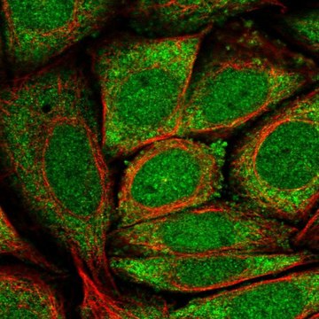 Anti-GK5 antibody produced in rabbit