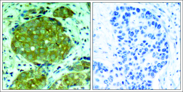 Anti-phospho-NFKB1 (pSer?³²) antibody produced in