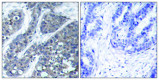 Anti-PYK2 antibody produced in rabbit