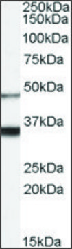 Anti-HCRTR1 antibody produced in goat