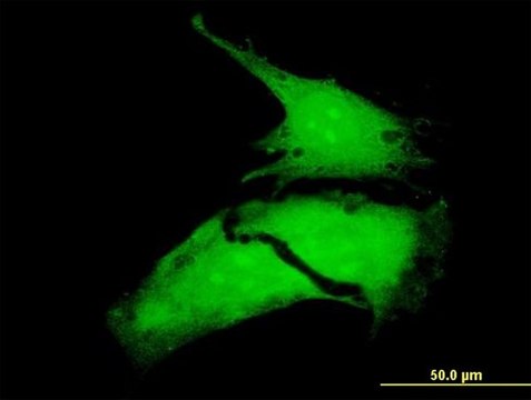ANTI-MKNK1 antibody produced in mouse