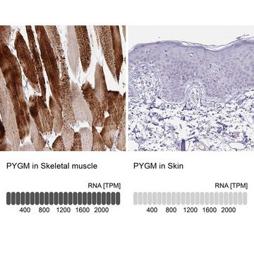 Anti-PYGM antibody produced in rabbit