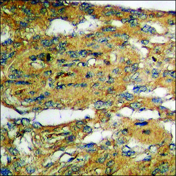 Anti-phospho-IKK-?/? (pSer180/181) antibody produced in
