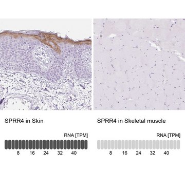 Anti-SPRR4 antibody produced in rabbit