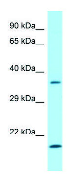 Anti-SGTA (C-terminal) antibody produced in
