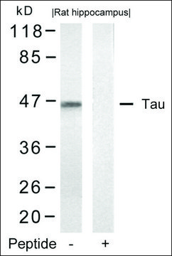 Anti-MAPT (Ab-422) antibody produced in