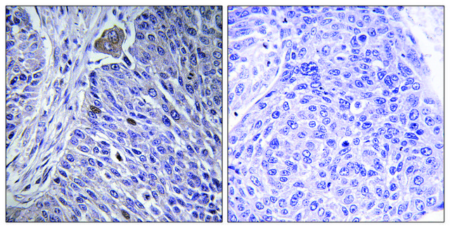 Anti-HNRPDL antibody produced in rabbit