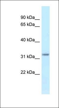 Anti-HSD17B11 antibody produced in rabbit