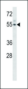 ANTI-MOUSE ACVR2A (N-TERM) antibody produced