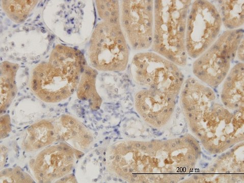 Monoclonal Anti-OCRL antibody produced in