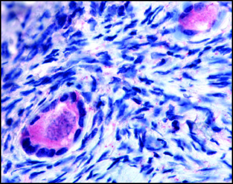 Anti-TMEM5 (AB2) antibody produced in