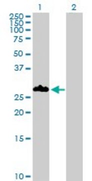 Anti-PNMT antibody produced in rabbit