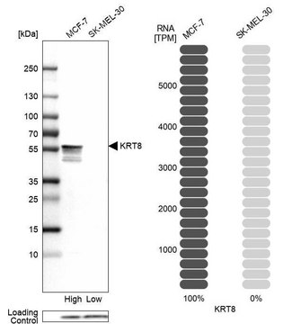 Anti-KRT8 antibody produced in rabbit