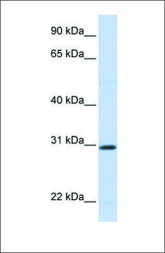 Anti-STC1 antibody produced in rabbit