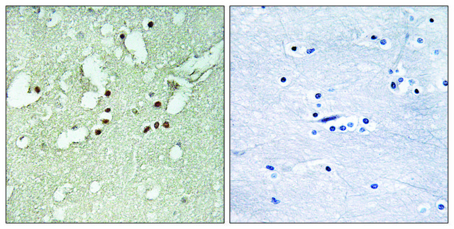 Anti-FOXJ3 antibody produced in rabbit