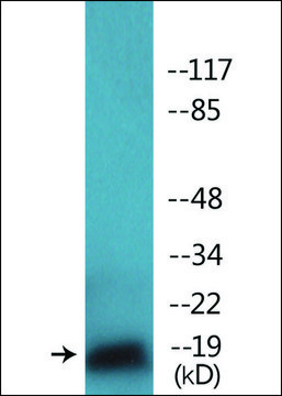 Anti-phospho-TEBP (pSer¹¹³) antibody produced in