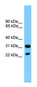 Anti-CD8B antibody produced in rabbit