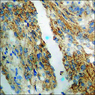 Anti-phospho-eNOS (pSer¹¹??) antibody produced in