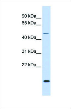 Anti-FOXN3 antibody produced in rabbit