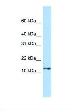 Anti-GNGT2 antibody produced in rabbit