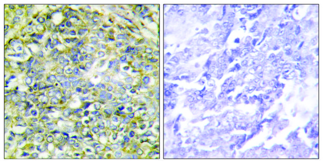 Anti-UBXD5 antibody produced in rabbit
