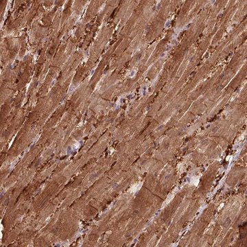 Anti-CCDC168 antibody produced in rabbit