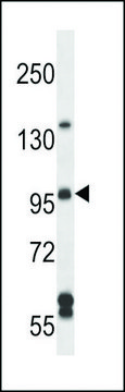 ANTI-SGEF (CENTER) antibody produced in