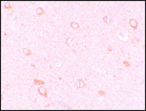 Anti-CIITA antibody produced in rabbit