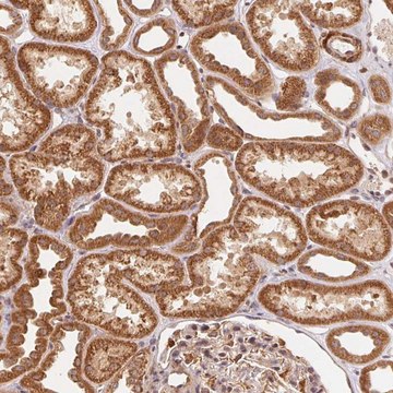 Anti-TNIP2 antibody produced in rabbit