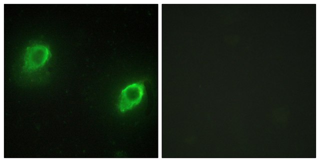 Anti-AKAP5 antibody produced in rabbit