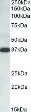 Anti-IDH3A (C-terminal) antibody produced in