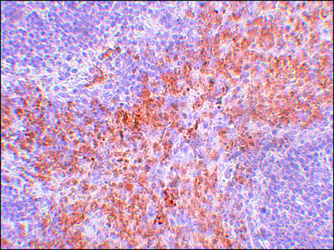 Anti-RIPK1 antibody produced in rabbit