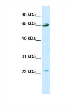 Anti-P2RX2 (ab4) antibody produced in