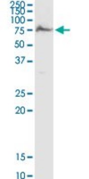 Anti-AK5 antibody produced in rabbit