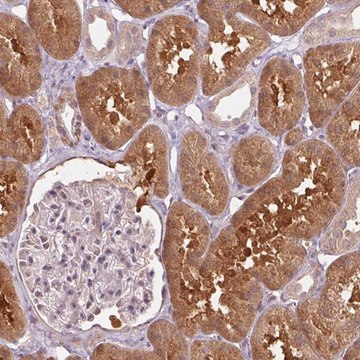 Anti-PPIA antibody produced in rabbit