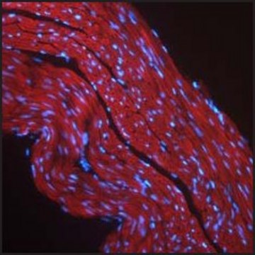 Anti-IGF1R antibody produced in rabbit