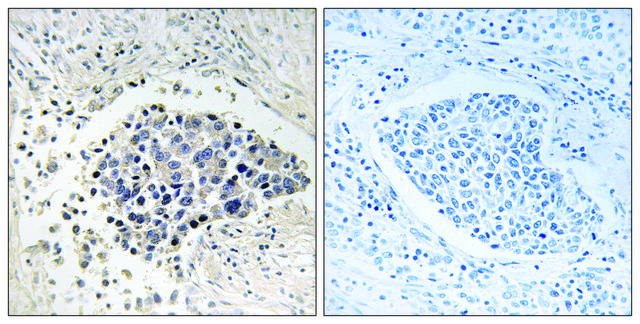 Anti-CPNE8 antibody produced in rabbit