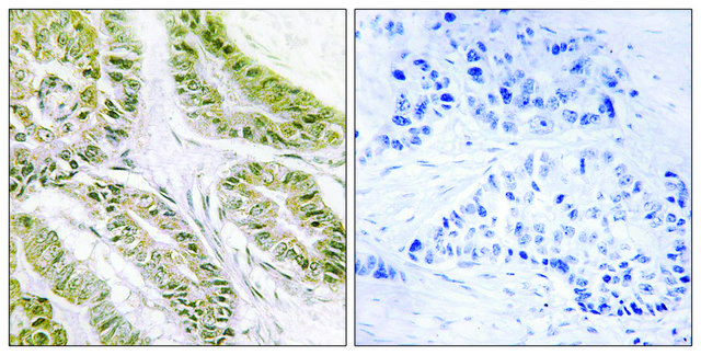 Anti-BAX antibody produced in rabbit