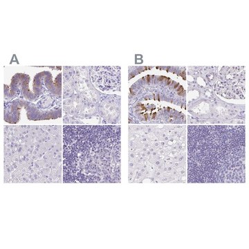 Anti-CAPSL antibody produced in rabbit
