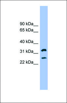 Anti-FCER1A, (N-terminal) antibody produced in