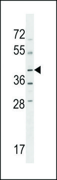 ANTI-NPRL2(C-TERMINAL) antibody produced in rabbit