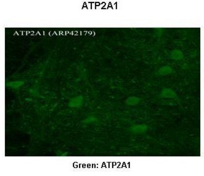Anti-ATP2A1, (N-terminal) antibody produced in