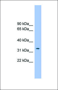 Anti-SLC25A1 antibody produced in rabbit