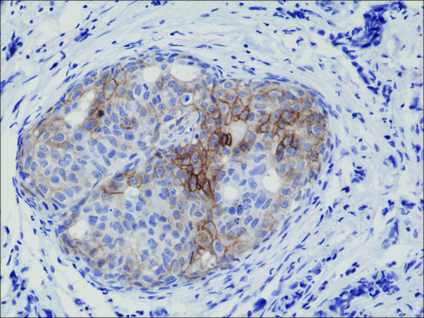 Anti-Phospho-EGFR (y1173) antibody, Rabbit monoclonal