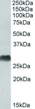 Anti-HLA-DQA2 (C-terminal) antibody produced in