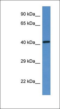 Anti-G6PC antibody produced in rabbit