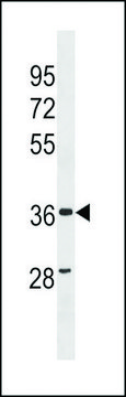 ANTI-ZC3HAV1L (C-TERM) antibody produced in
