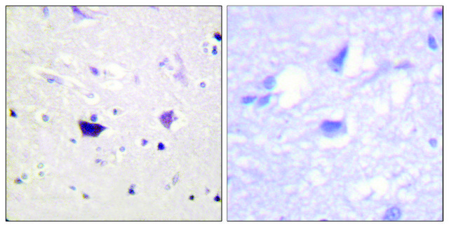 Anti-PAK1 antibody produced in rabbit